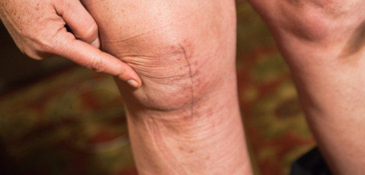 Unusual Pain-Relieving Home Remedies You’ve Never Heard About